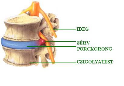 A gerincsérv előjelei és kezelése